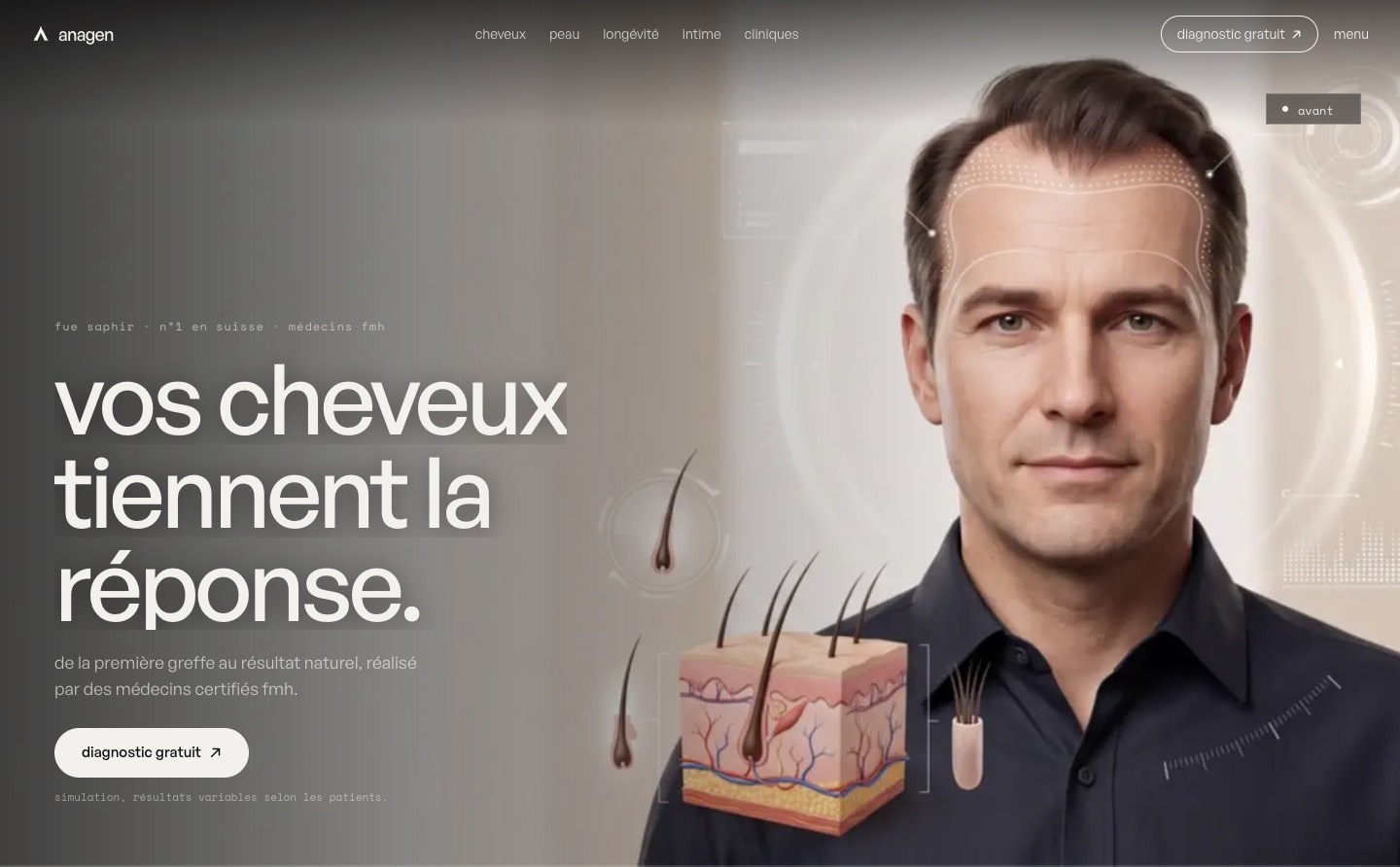 Capture du site ANAGEN, clinique capillaire et esthétique en Suisse